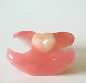 Vaplast unilateral one tooth denture