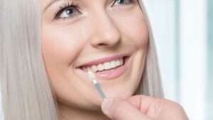 Veneers Harm Your Natural Teeth