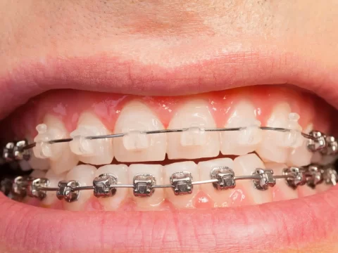 AdobeStock_131762441 AdobeStock_131762441