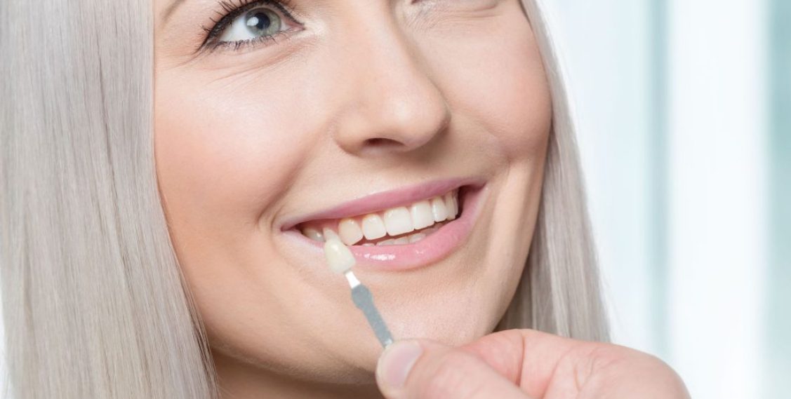 Veneers Harm Your Natural Teeth