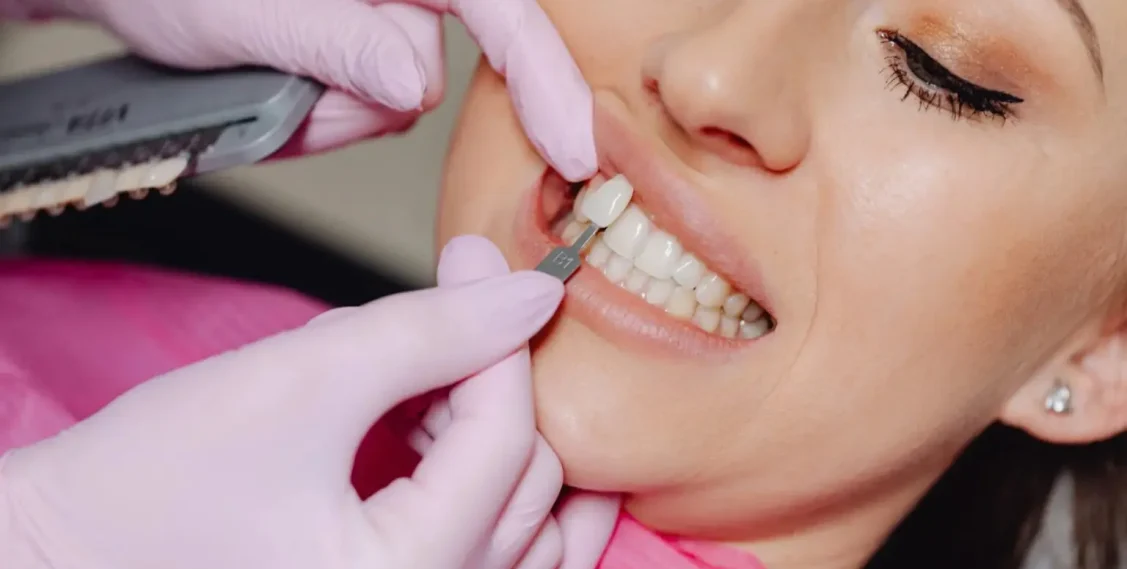 do veneers harm your teeth