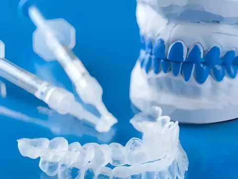 Teeth Whitening Annerley